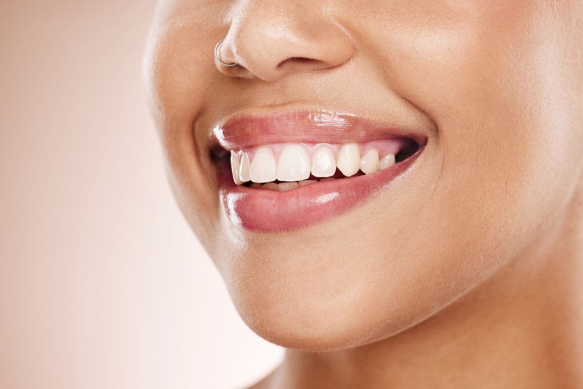 cosmetic dentistry aftercare