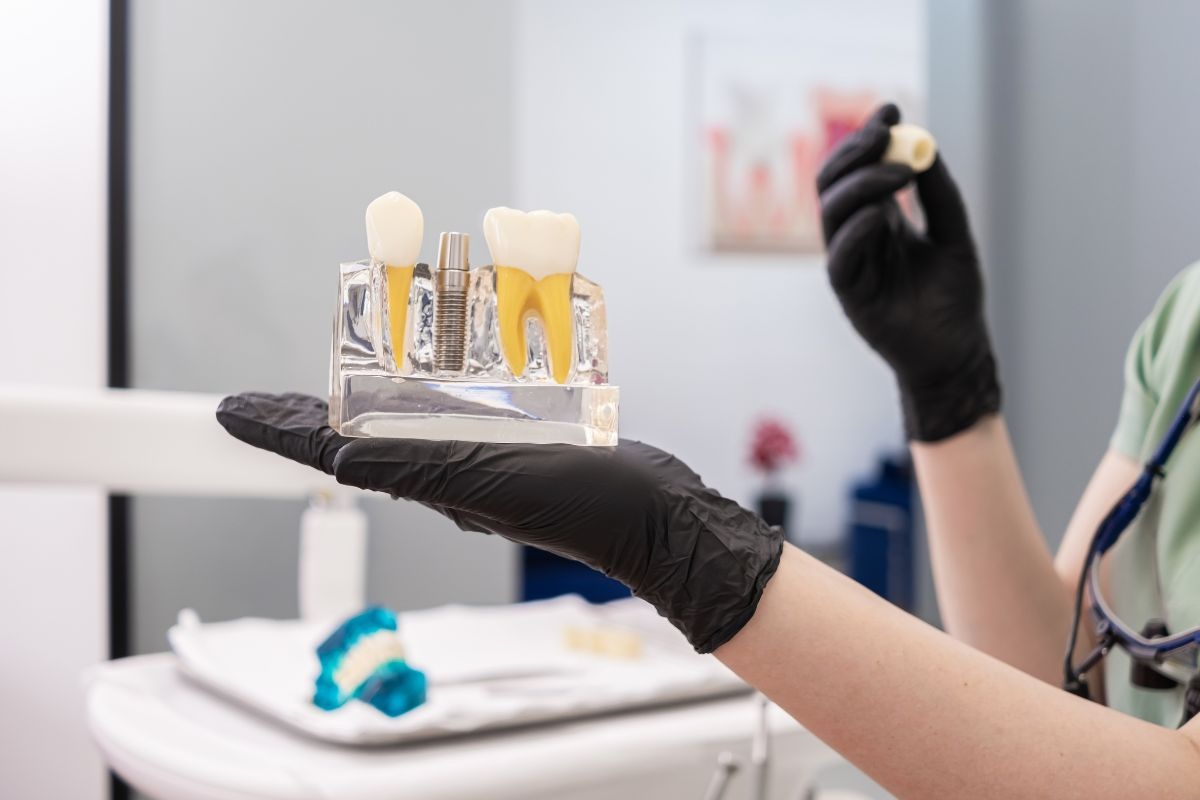 dental implant aftercare